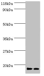 Anti-RPS19