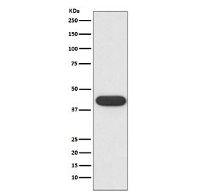 Anti-CD32 / FCGR2A, clone AABD-6