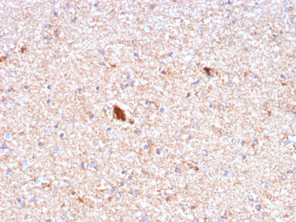 Anti-Serum Amyloid P / APCS, clone APCS/3240