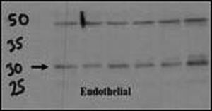 Anti-DSCR1