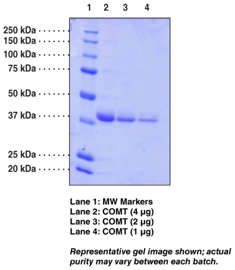 S-Catechol O-Methyltransferase (human, recombinant)