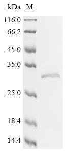 ADP/ATP translocase 1 (SLC25A4), recombinant human