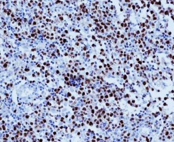 Anti-IRF4 / MUM1, clone SQab20188