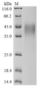 Interferon gamma receptor 1 (IFNGR1), partial, human, recombinant