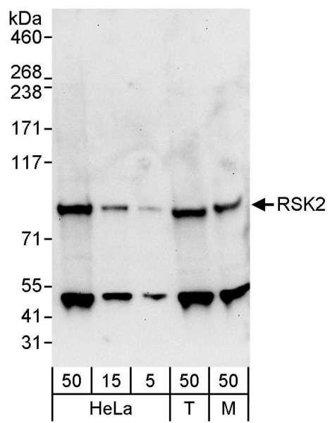 Anti-RSK2