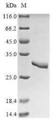 Asialoglycoprotein receptor 1 (Asgr1), partial, rat, recombinant
