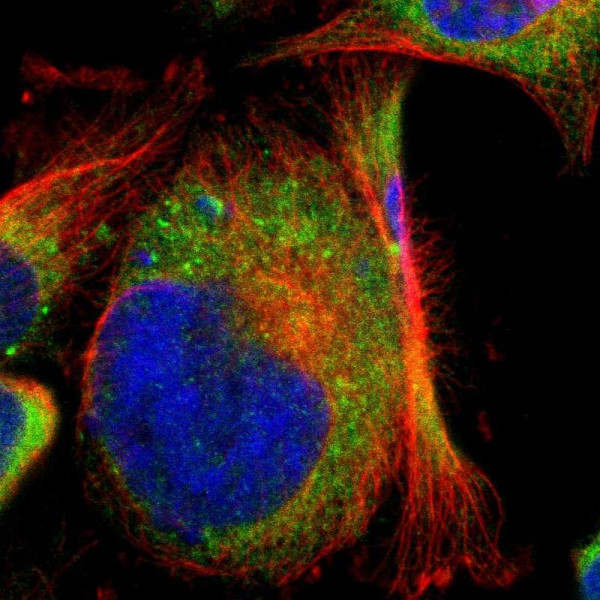 Anti-CLCC1