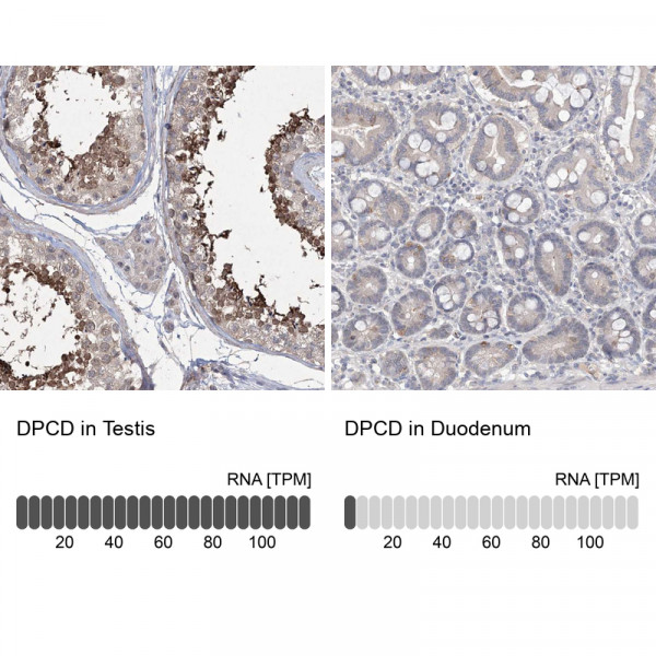 Anti-DPCD