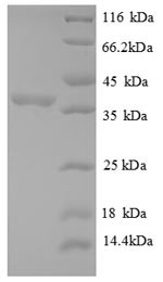 60S acidic ribosomal protein P2 (RPLP2), partial, recombinant human