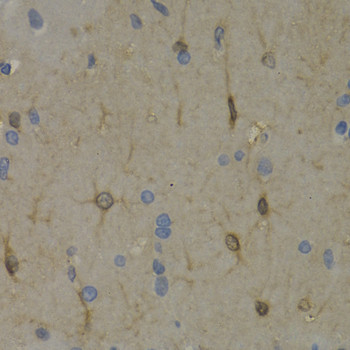 Anti-WNT3A