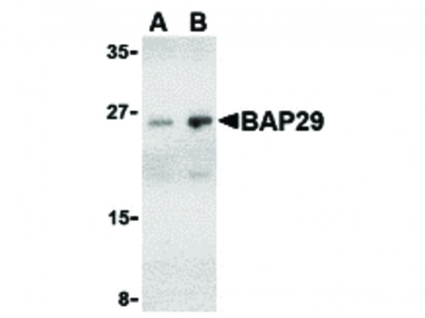 Anti-BAP29