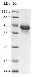 Follicle-stimulating hormone receptor (FSHR), partial, human, recombinant