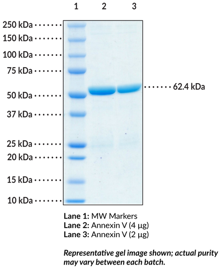 Annexin V (human, recombinant)