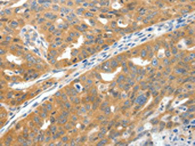 Anti-SCN9A