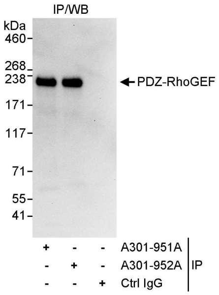 Anti-PDZ-RhoGEF