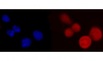 Anti-PCBP2 / hnRNP E2, clone 4B9C7