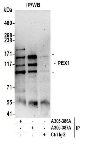 Anti-PEX1