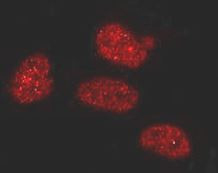 Anti-PARP (cleaved p85)