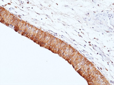 Anti-UP2 (Uroplakin-2) (human), Rabbit Monoclonal (RM507)