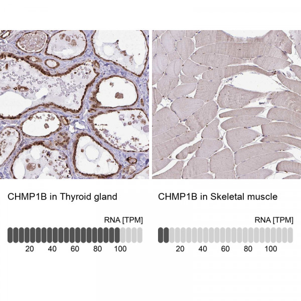 Anti-CHMP1B