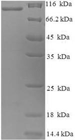 Melanotransferrin (Mfi2), partial, rabbit, recombinant