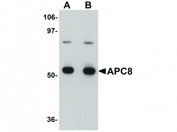Anti-APC8