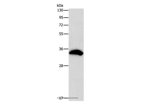 Anti-CDCA8