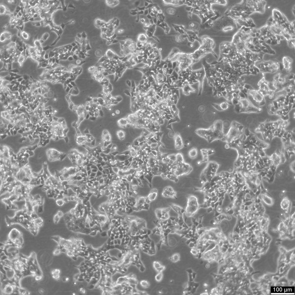 RL95-2 Cells
