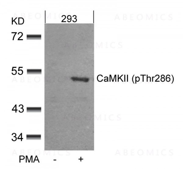 Anti-phospho-CaMKII (Thr286)