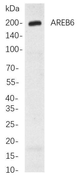 Anti-Recombinant AREB6, clone 3P12