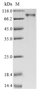 E3 ubiquitin-protein ligase RNF168 (RNF168), human, recombinant
