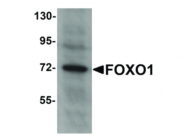 Anti-FOXO1