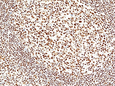 Anti-INI1 (SNF5/SMARCB1), Rabbit Monoclonal (RM468)