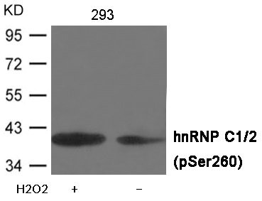 Anti-Phospho-HNRNPC (Ser260)