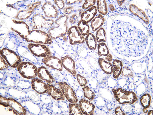 Anti-Recombinant Napsin A, clone C312424