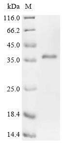 Low-density lipoprotein receptor-related protein 2 (Lrp2), partial, rat, recombinant