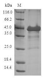 Cytosolic beta-glucosidase (GBA3), human, recombinant
