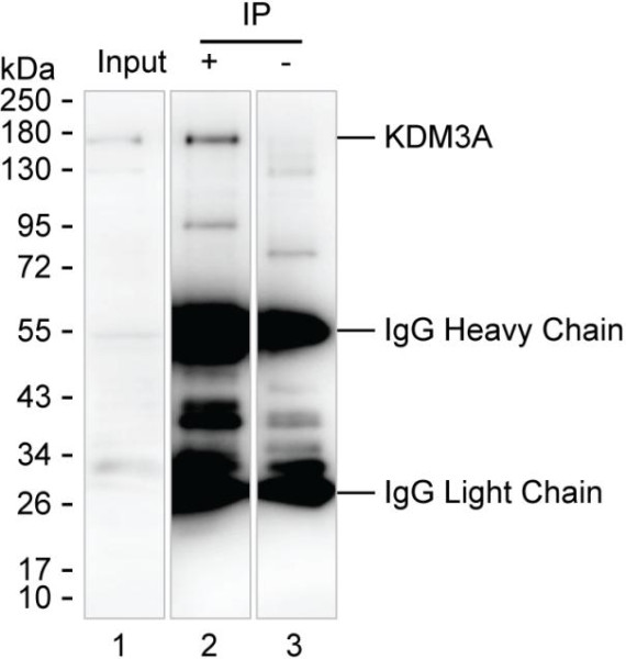 Anti-KDM3A