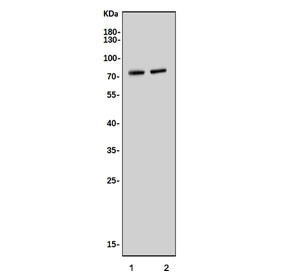 Anti-Narc1 / Neural apoptosis-regulated convertase 1 / Pcsk9