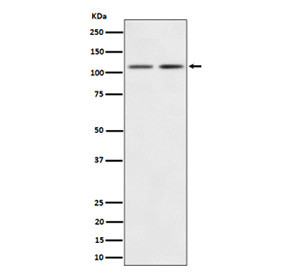 Anti-PIK3CB / PI3 Kinase p110 beta, clone 30P53
