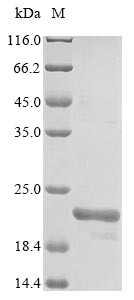 Monocarboxylate transporter 5 (SLC16A4), partial, human, recombinant