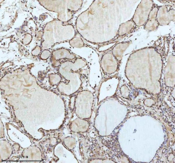 Anti-IRF2BPL / Interferon regulatory factor 2 binding protein-like