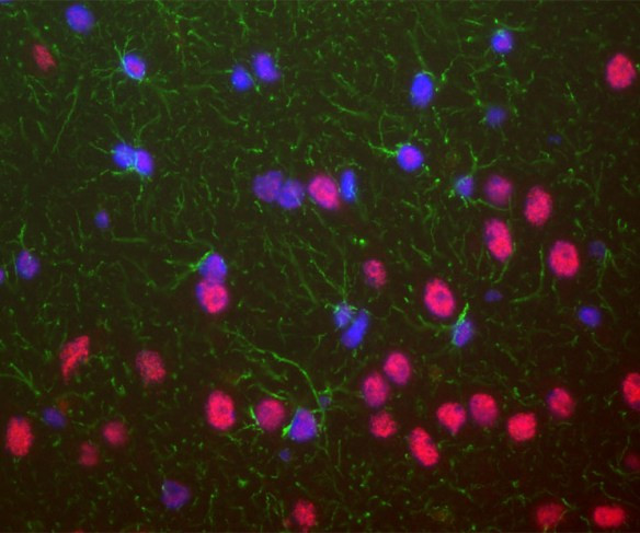 Anti-TDP43, clone 3H8
