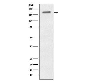 Anti-phospho-EGF Receptor / EGFR (Tyr1173), clone EHG-5