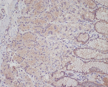 Anti-MET / c-Met / HGFR, clone BFA-13