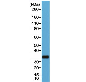 Anti-CD20, clone RM272 (recombinant antibody)