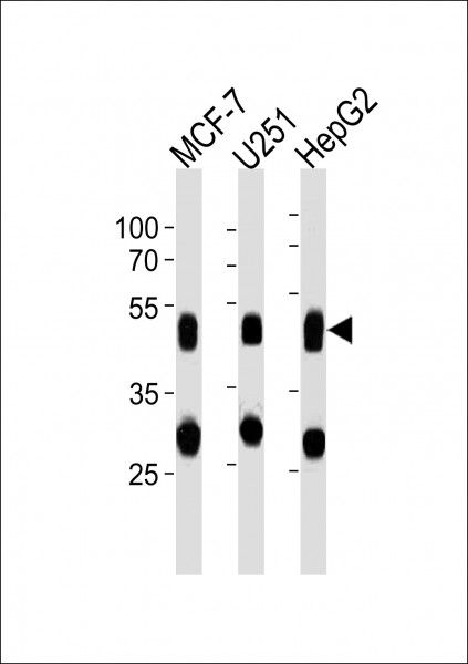 Anti-Cathepsin D