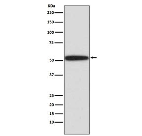 Anti-p53 / TP53, clone AGC-20