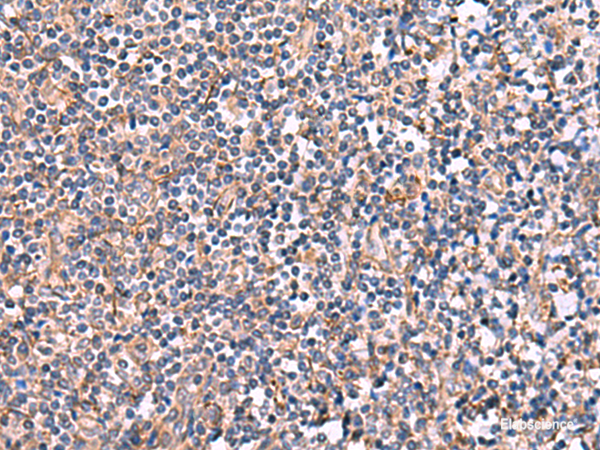 Anti-INPP5B