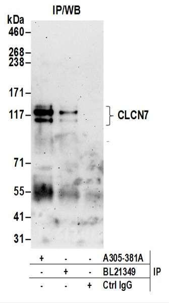 Anti-CLCN7